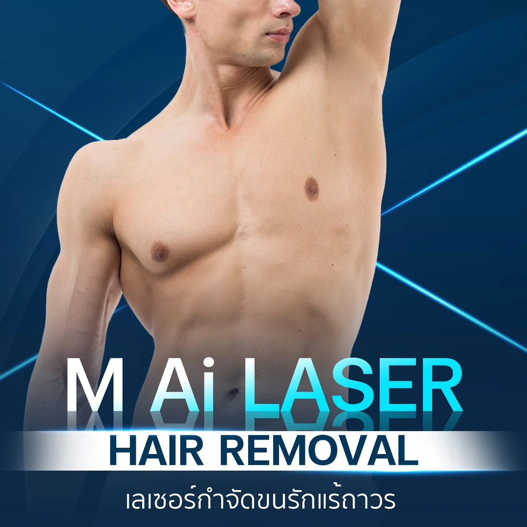 เลเซอร์ AI กำจัดขนรักแร้ 1 ครั้ง (ผู้ชายเท่านั้น)