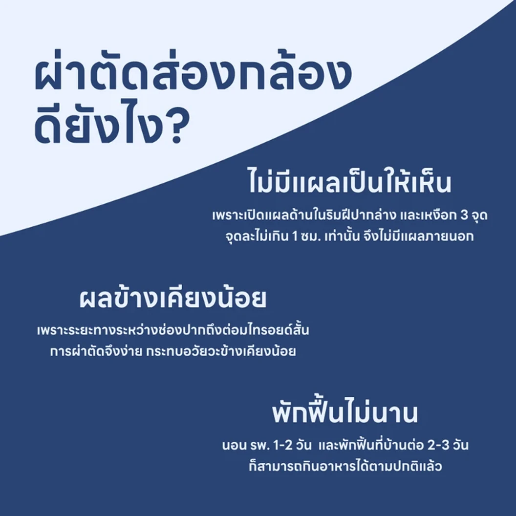 ผ่าตัดไทรอยด์แบบส่องกล้อง