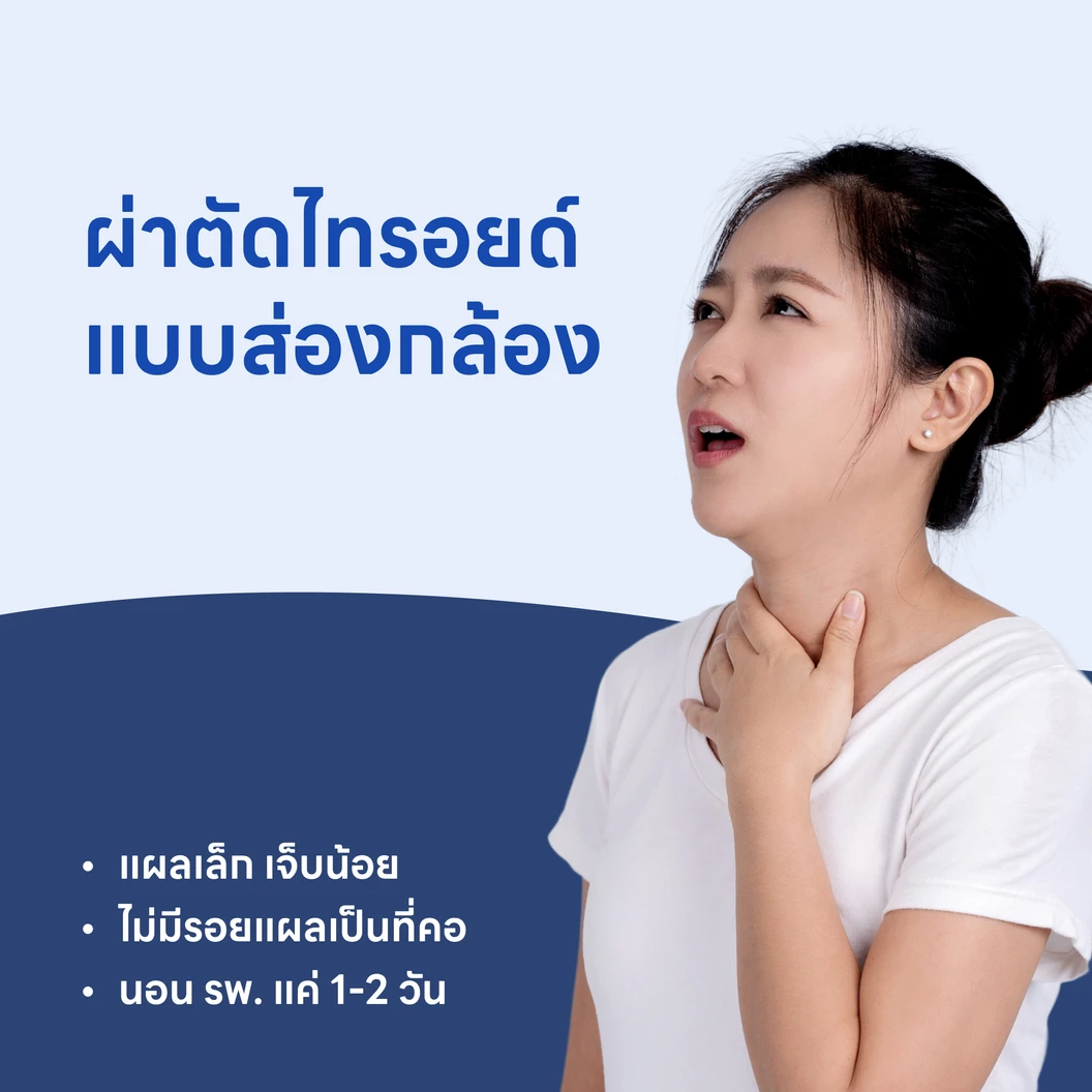 ผ่าตัดไทรอยด์แบบส่องกล้อง