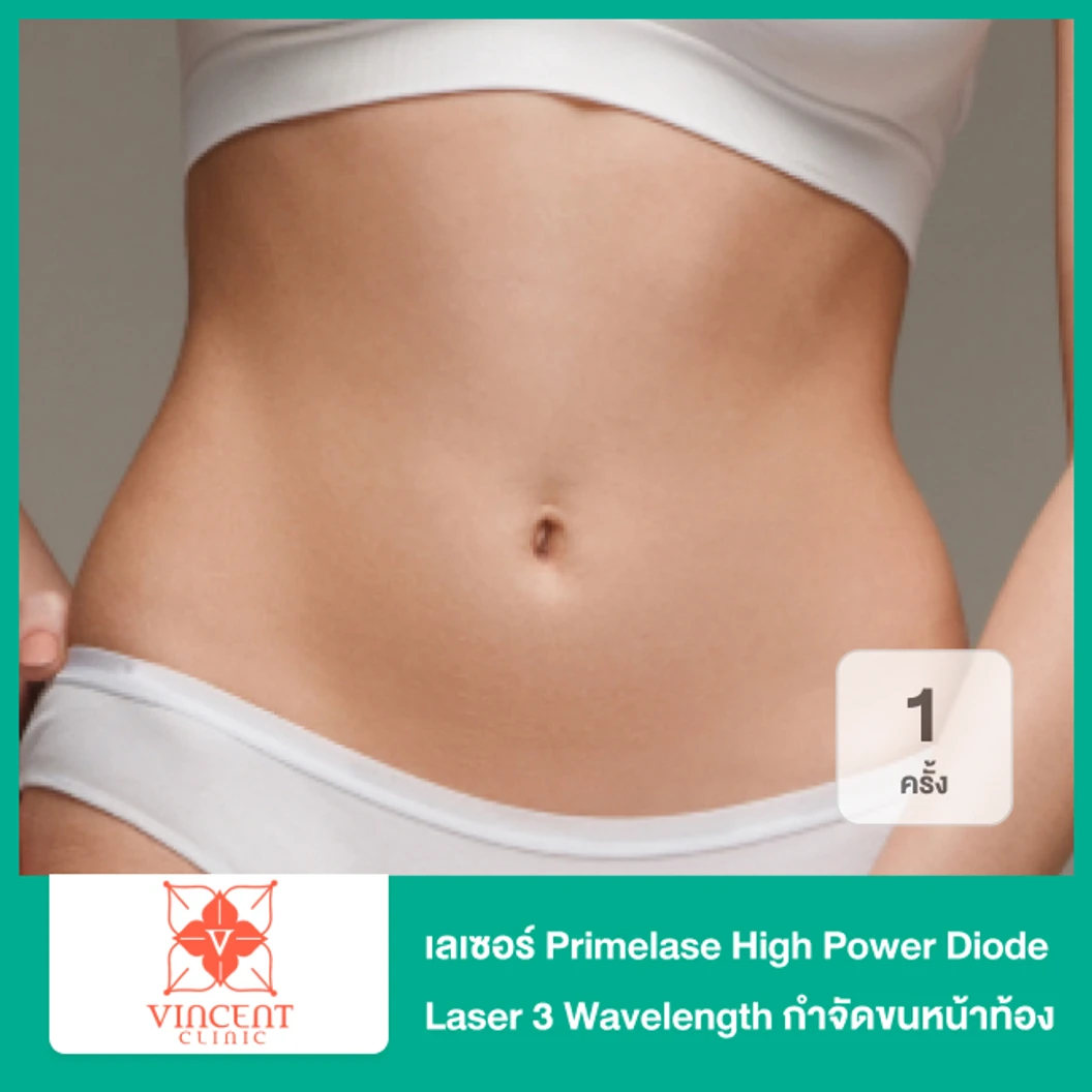 เลเซอร์ Primelase High Power Diode Laser 3 Wavelength กำจัดขนหน้าท้อง 1 ครั้ง
