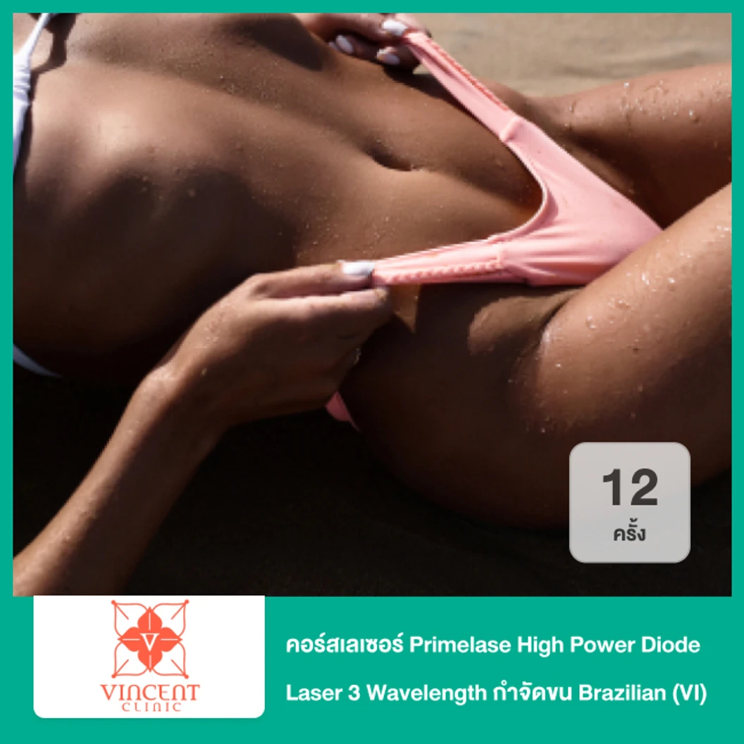 คอร์สเลเซอร์ Primelase High Power Diode Laser 3 Wavelength กำจัดขน Brazilian (VI) 12 ครั้ง ฟรี! 2 ครั้ง
