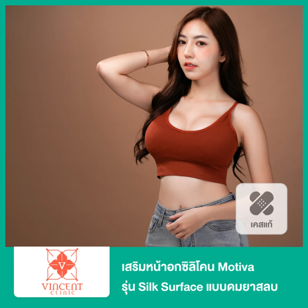 เสริมหน้าอกซิลิโคน Motiva รุ่น Silk Surface แบบดมยาสลบ (จำนวนซีซีขึ้นอยู่กับแพทย์ประเมิน)(เคสแก้)
