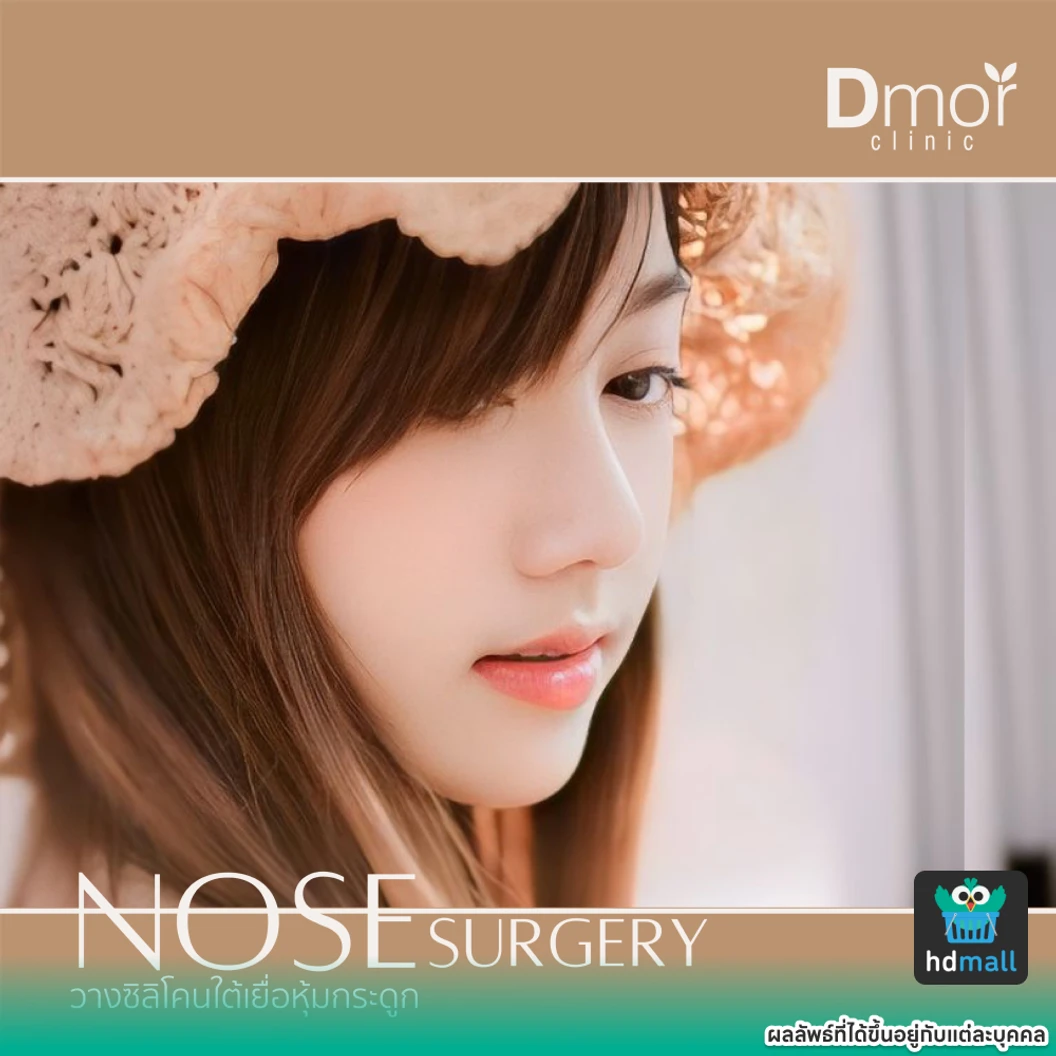 เสริมจมูกซิลิโคนอเมริกา Implant Grade เทคนิค Close (ครั้งแรก)