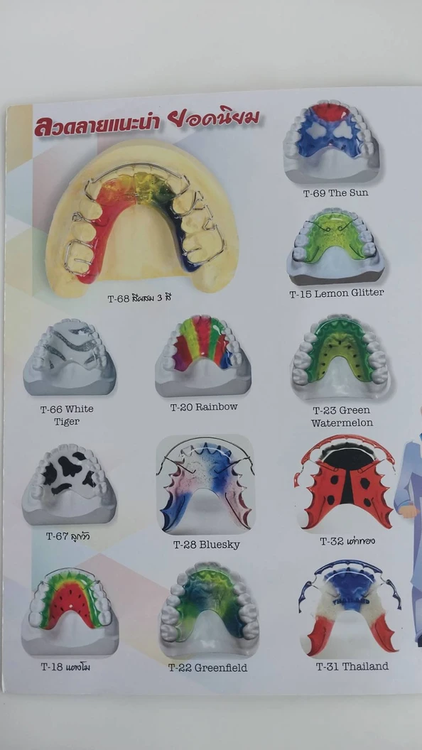 ทำรีเทนเนอร์แบบลวด 1 ชิ้น