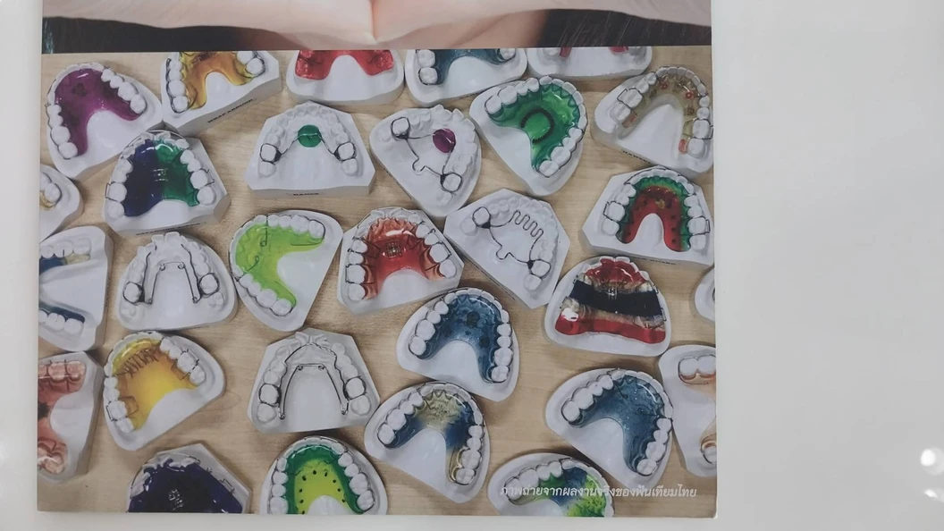 ทำรีเทนเนอร์แบบลวด 1 ชิ้น