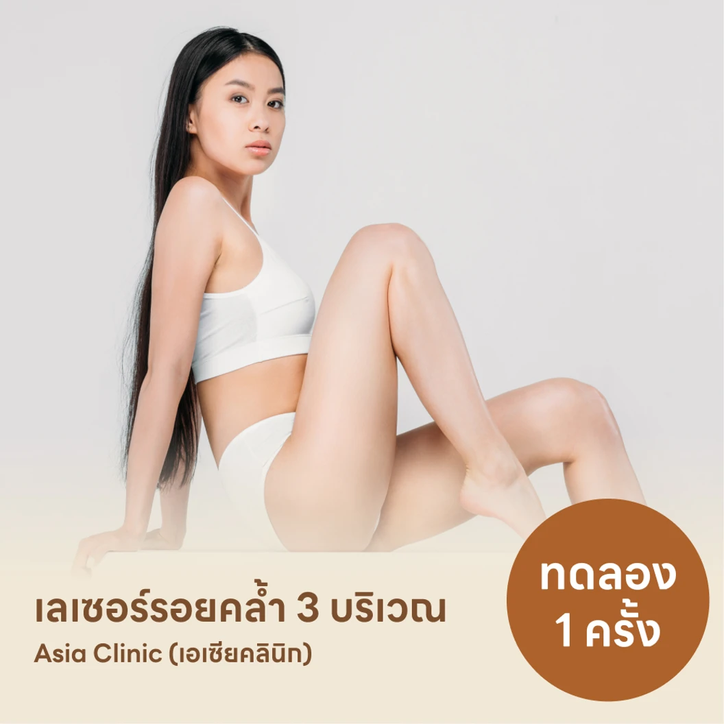 โปรแกรมรักษารอยคล้ำด้วยเลเซอร์ Q-Switch เลือก 3 บริเวณ 1 ครั้ง