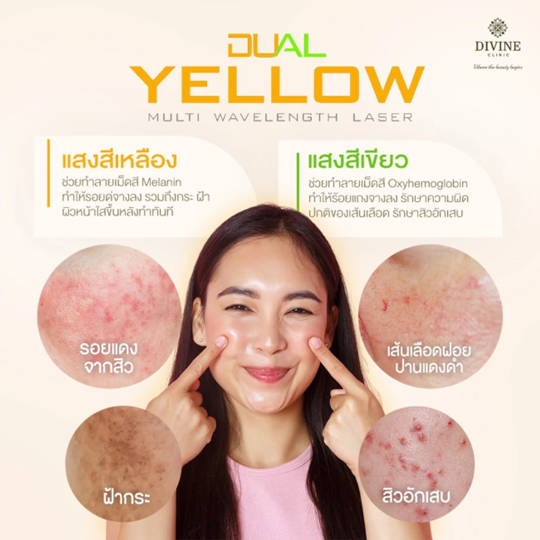 โปรแกรมรักษาฝ้า 3 ขั้นตอน (Dual Yellow Melasma Mode) 1 ครั้ง