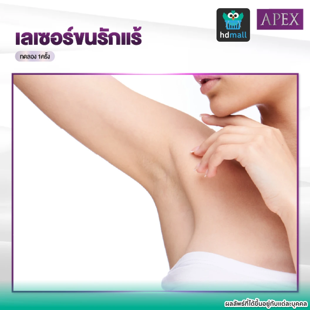 เลเซอร์ Dynamic Tech กำจัดขนรักแร้ 1 ครั้ง (ราคาทดลอง)