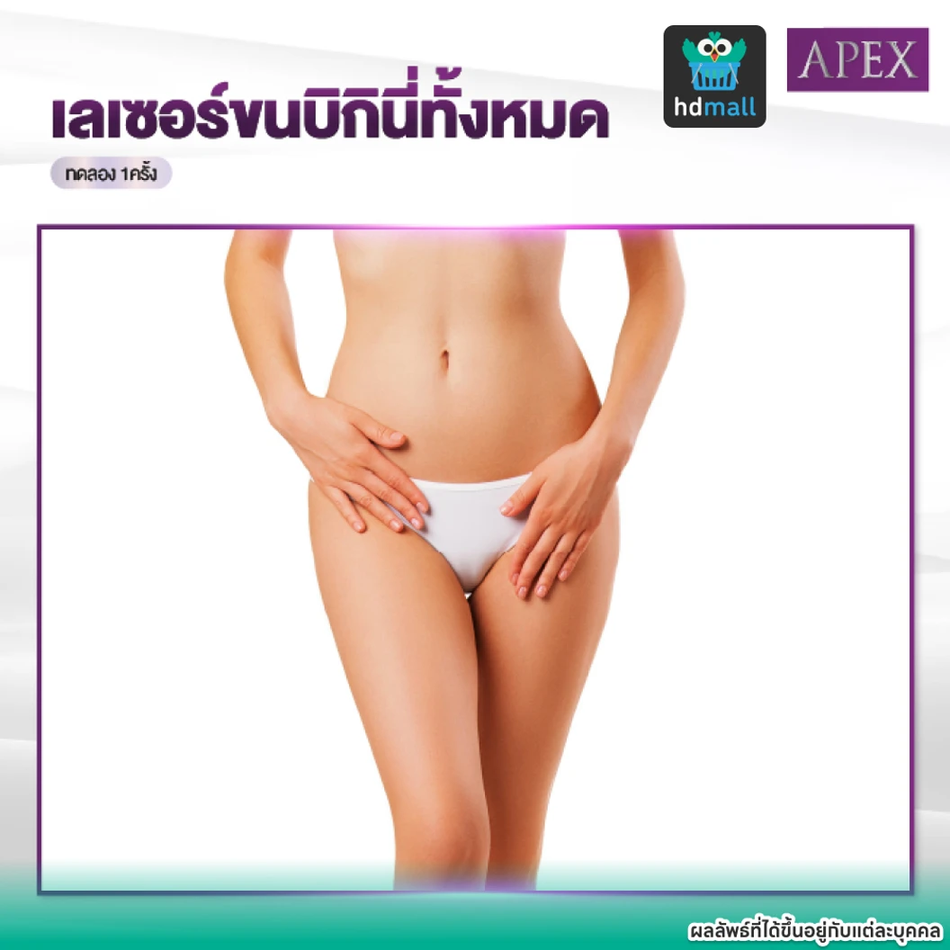 เลเซอร์ Dynamic Tech กำจัดขน Bikini (V) 1 ครั้ง (ราคาทดลอง)