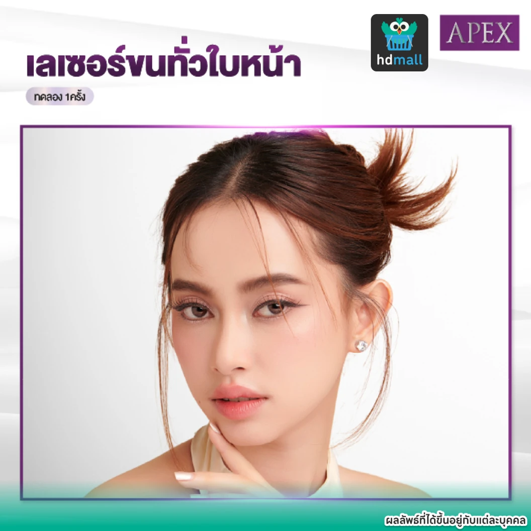 เลเซอร์ Dynamic Tech กำจัดขนหน้า 1 ครั้ง (ราคาทดลอง)