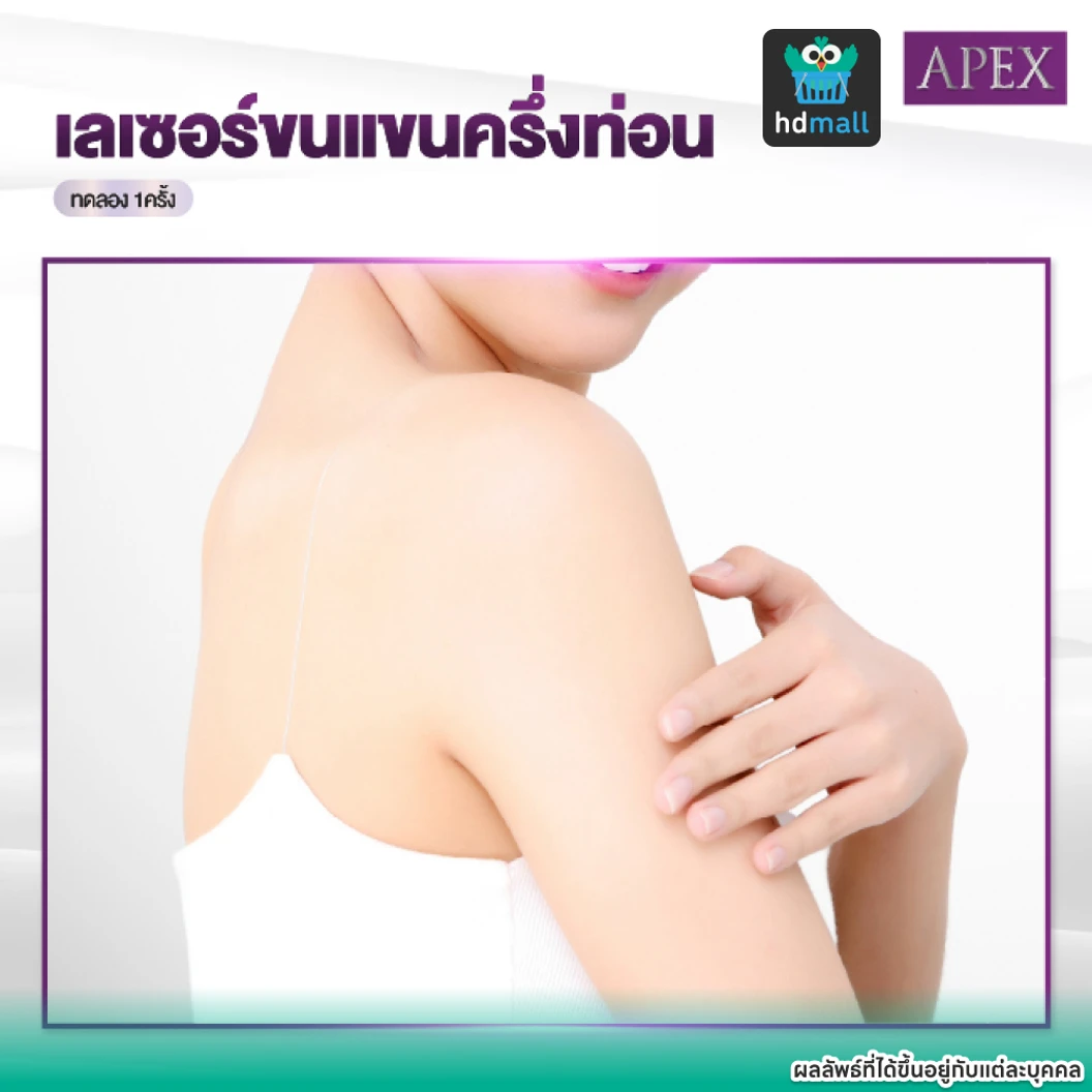เลเซอร์ Dynamic Tech กำจัดขน (เลือก 1 จุด แขนบน/แขนล่าง) 1 ครั้ง (ราคาทดลอง)