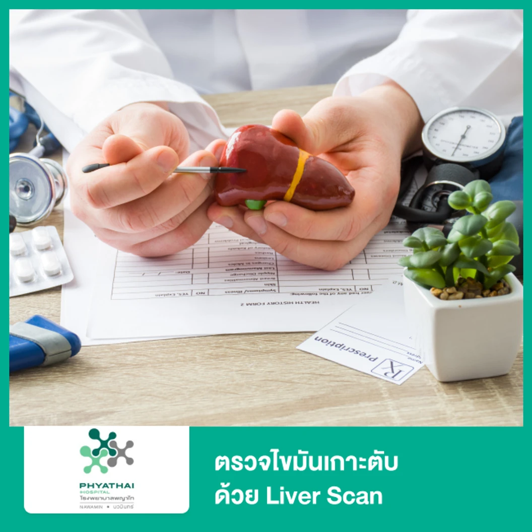 ตรวจไขมันเกาะตับด้วย Liver Scan