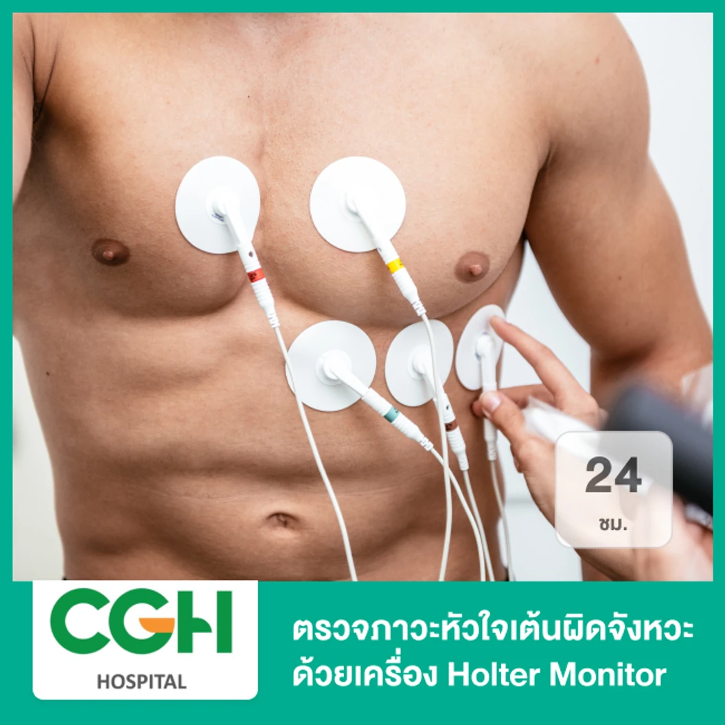 ตรวจภาวะหัวใจเต้นผิดจังหวะ ด้วยเครื่อง Holter Monitor 24 ชั่วโมง