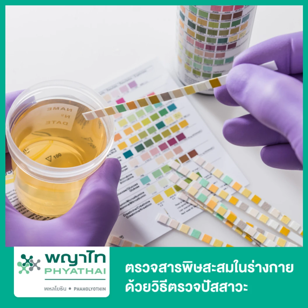 ตรวจสารพิษสะสมในร่างกาย ด้วยวิธีตรวจปัสสาวะ