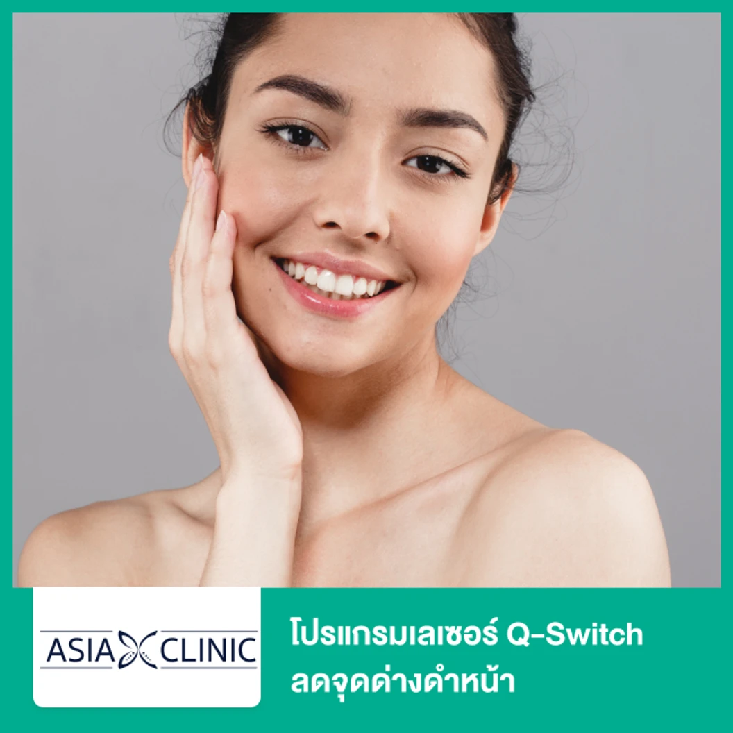 โปรแกรมเลเซอร์ Q-Switch ลดจุดด่างดำหน้า