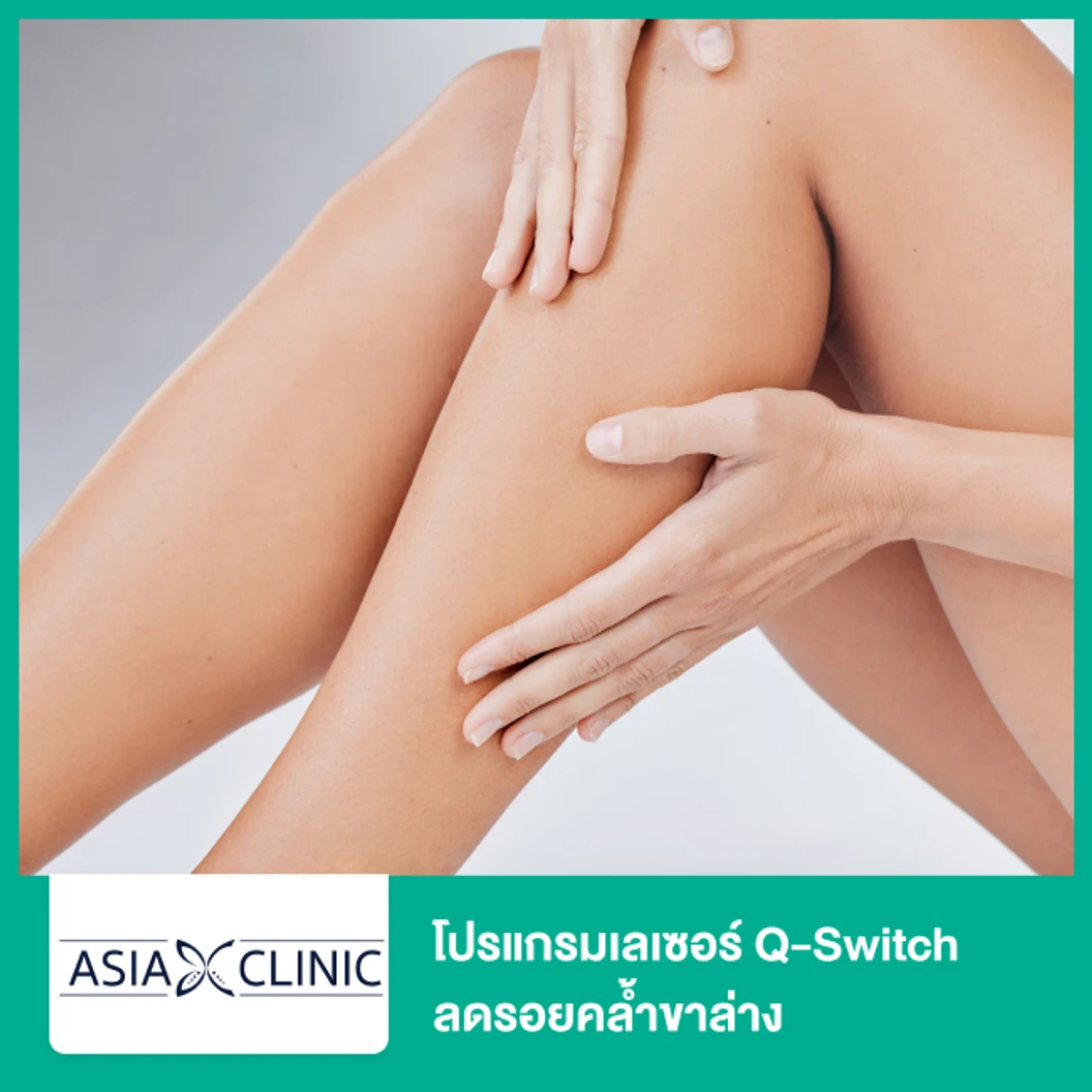 โปรแกรมเลเซอร์ Q-Switch ลดรอยคล้ำขาล่าง