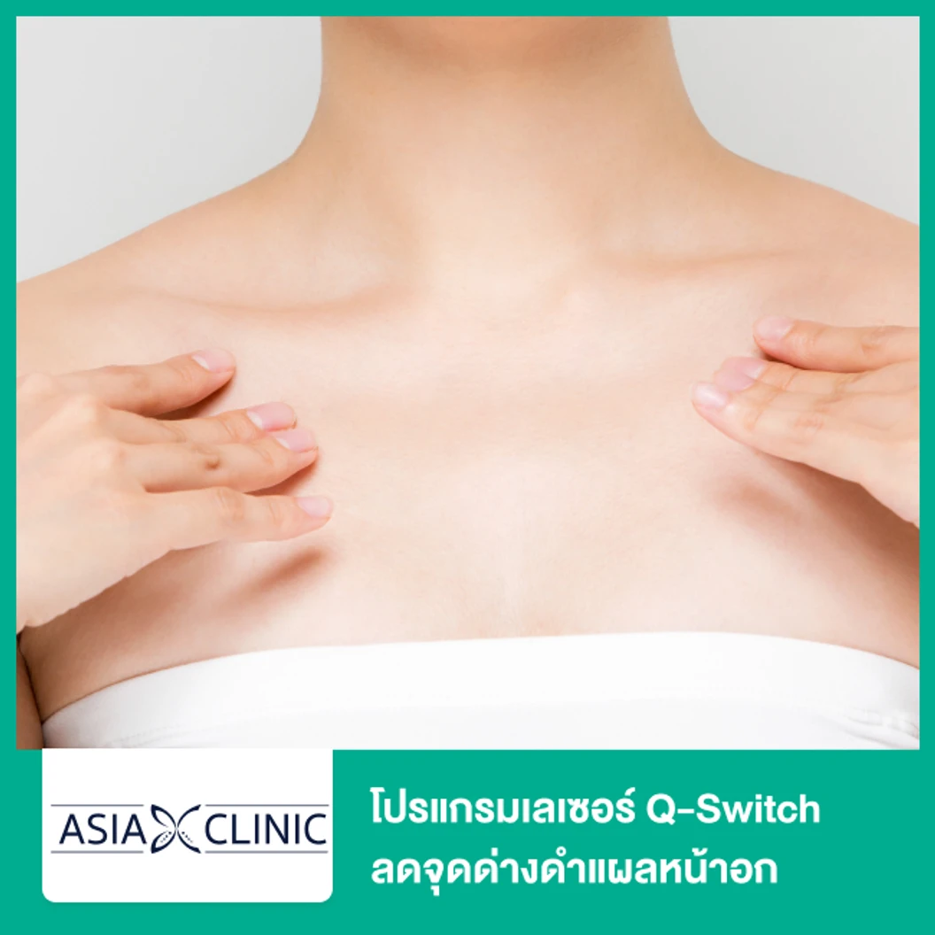โปรแกรมเลเซอร์ Q-Switch ลดจุดด่างดำแผลหน้าอก