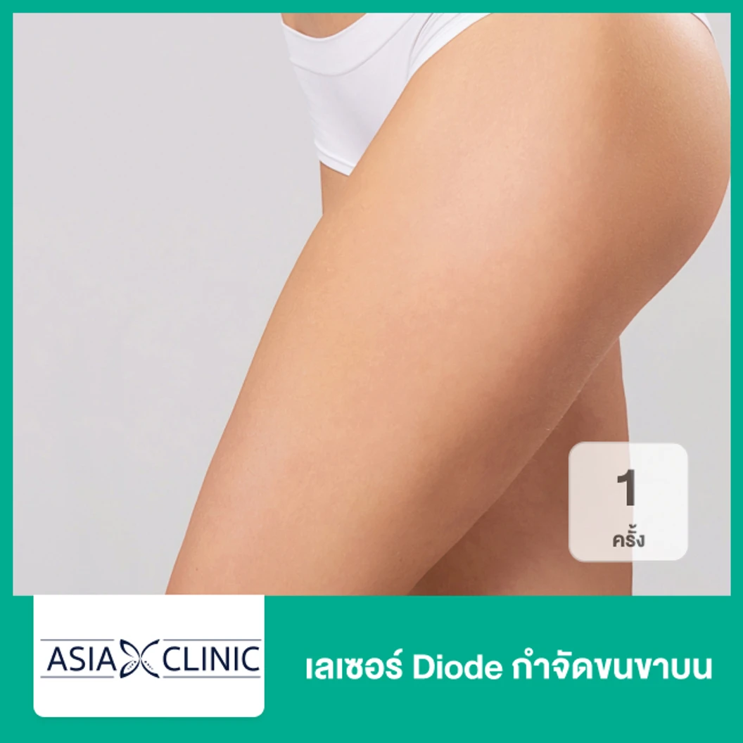 เลเซอร์ Diode กำจัดขนขาบน 1 ครั้ง