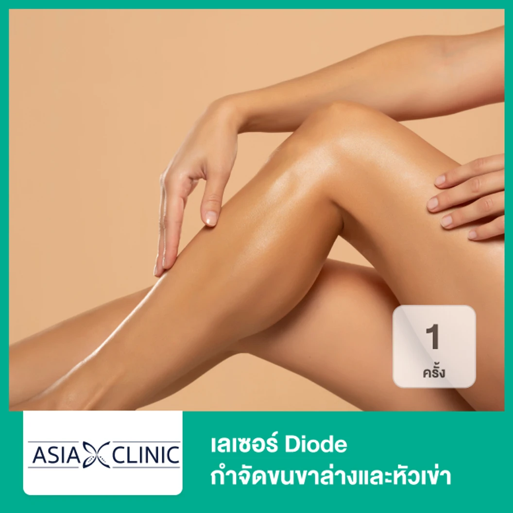 เลเซอร์ Diode กำจัดขนขาล่างและหัวเข่า 1 ครั้ง