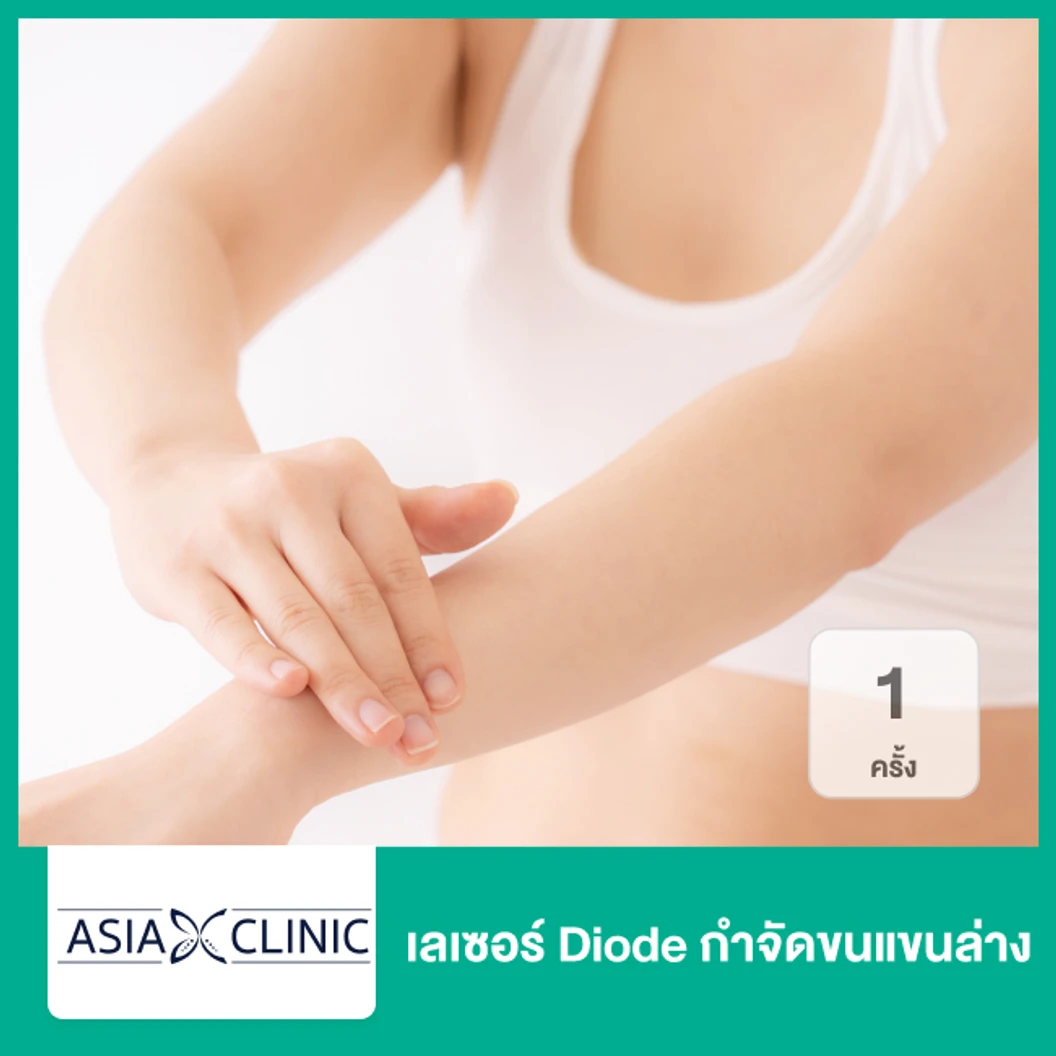 เลเซอร์ Diode กำจัดขนแขนล่าง 1 ครั้ง