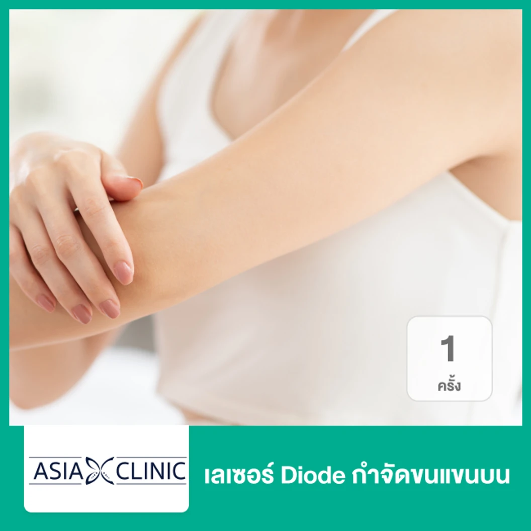 เลเซอร์ Diode กำจัดขนแขนบน 1 ครั้ง