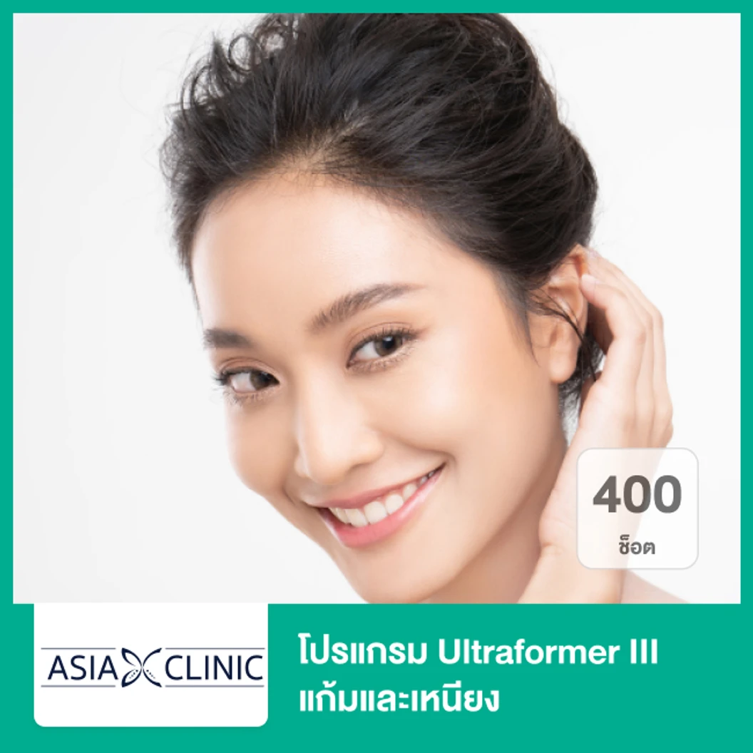 โปรแกรม Ultraformer III แก้มและเหนียง 400 ช็อต