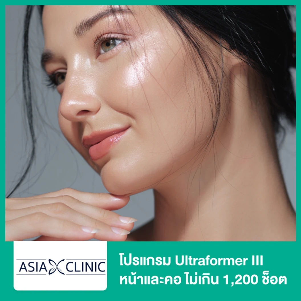 โปรแกรม Ultraformer III หน้าและคอ ไม่เกิน 1,200 ช็อต
