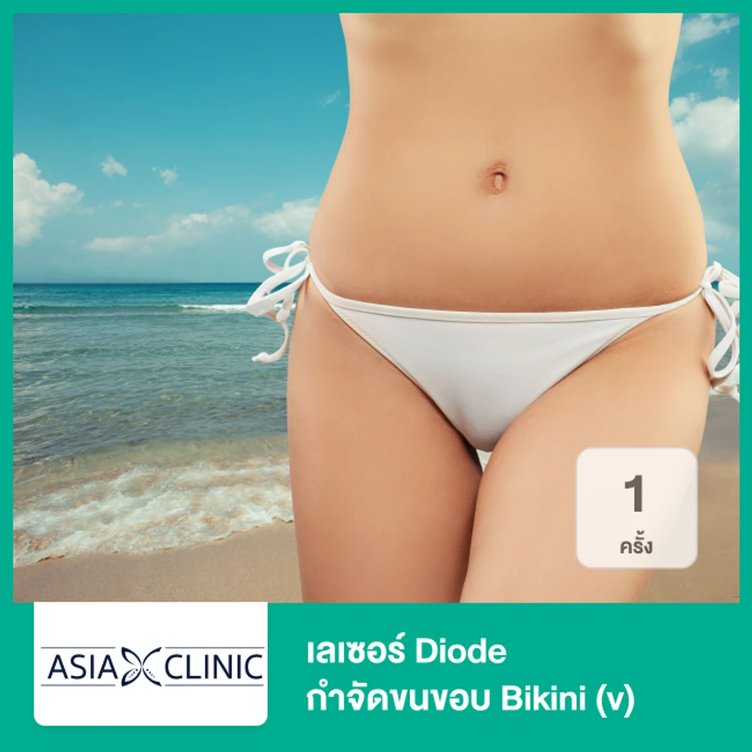 เลเซอร์ Diode กำจัดขนขอบ Bikini (v) 1 ครั้ง