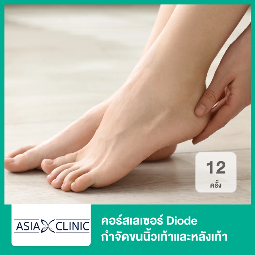 คอร์สเลเซอร์ Diode กำจัดขนนิ้วเท้าและหลังเท้า 12 ครั้ง