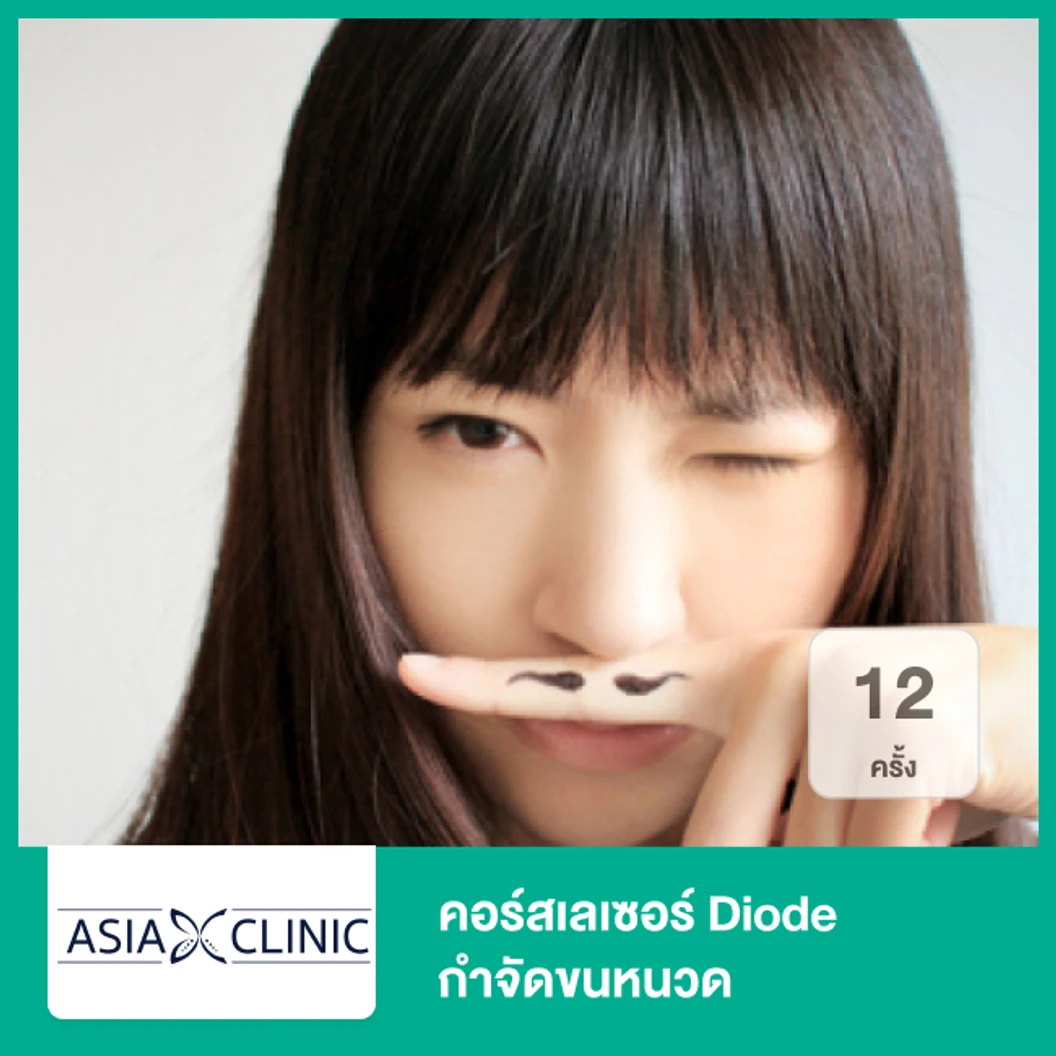 คอร์สเลเซอร์ Diode กำจัดขนหนวด 12 ครั้ง
