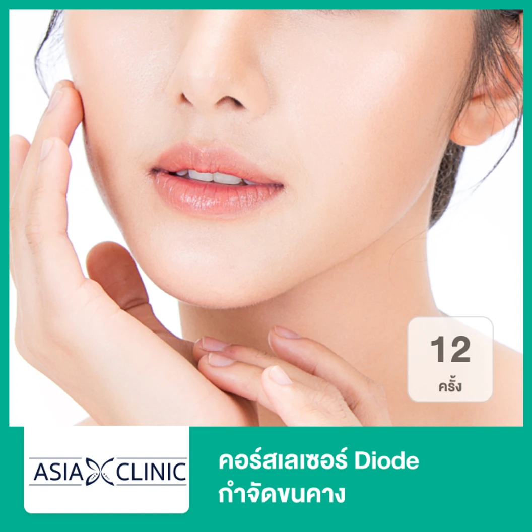 คอร์สเลเซอร์ Diode กำจัดขนคาง 12 ครั้ง