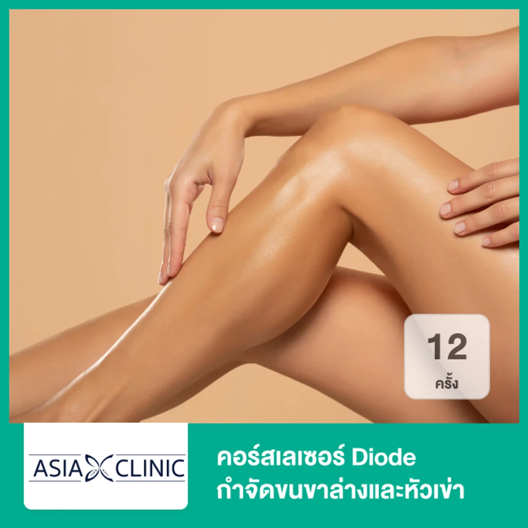 คอร์สเลเซอร์ Diode กำจัดขนขาล่างและหัวเข่า 12 ครั้ง