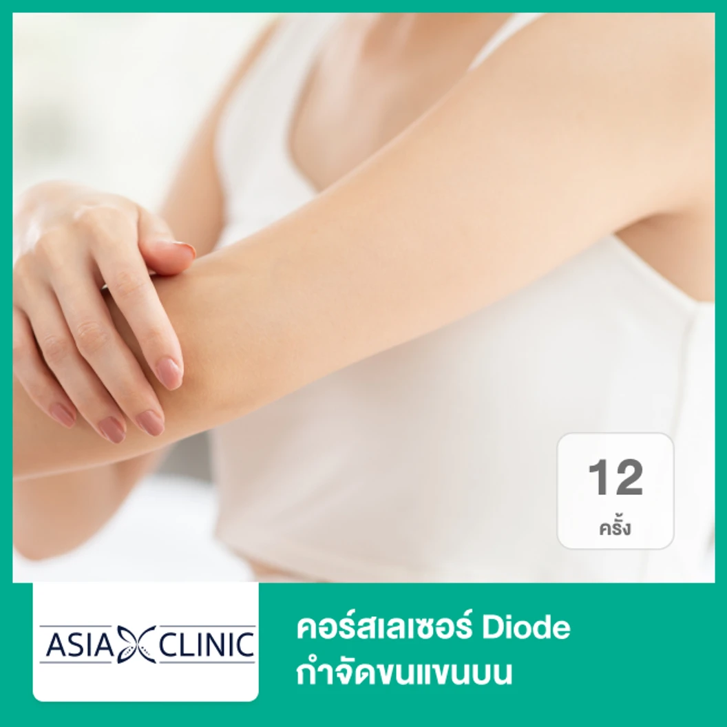 คอร์สเลเซอร์ Diode กำจัดขนแขนบน 12 ครั้ง