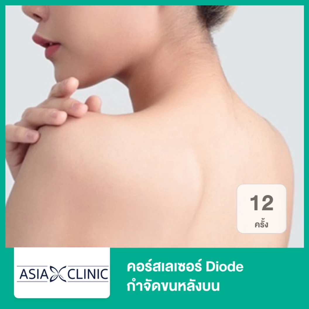 คอร์สเลเซอร์ Diode กำจัดขนหลังบน 12 ครั้ง