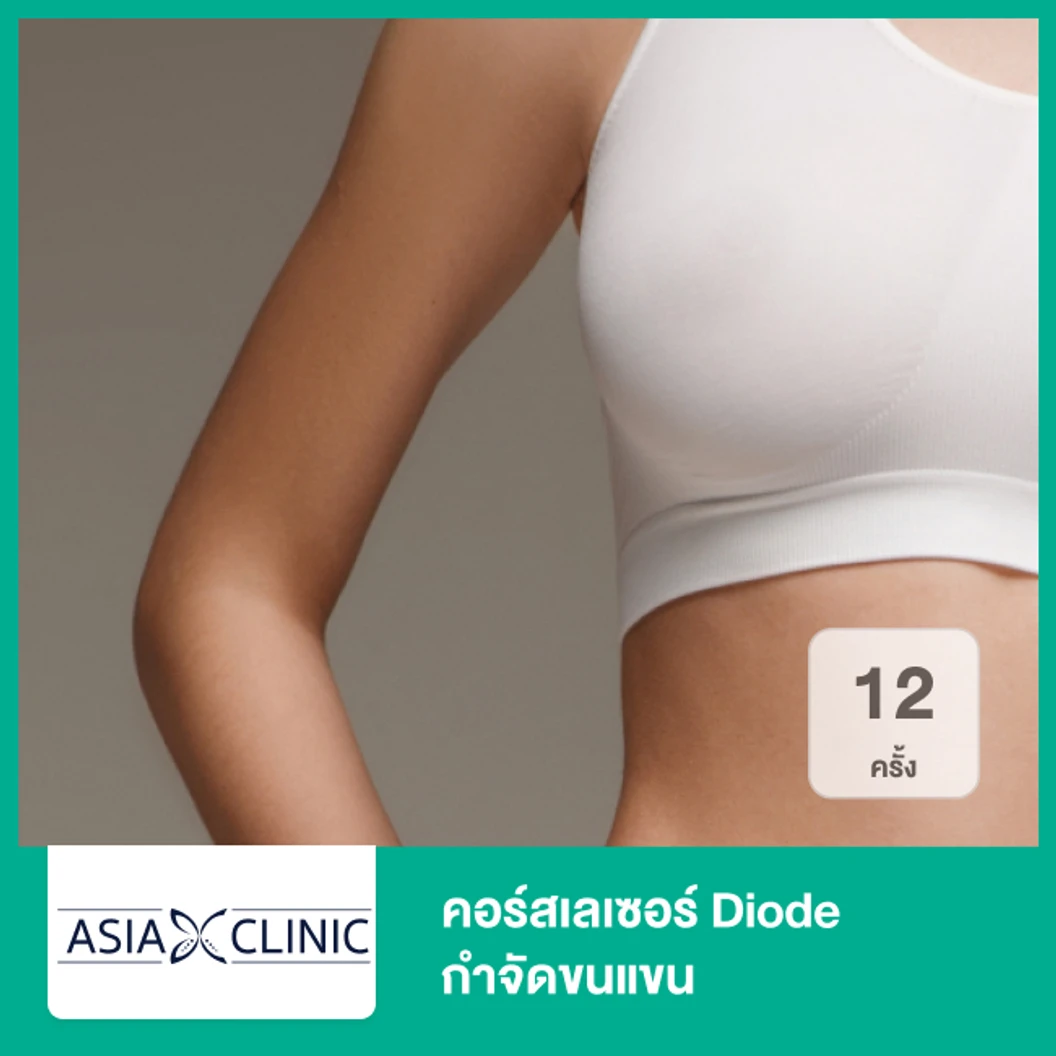 คอร์สเลเซอร์ Diode กำจัดขนแขน 12 ครั้ง