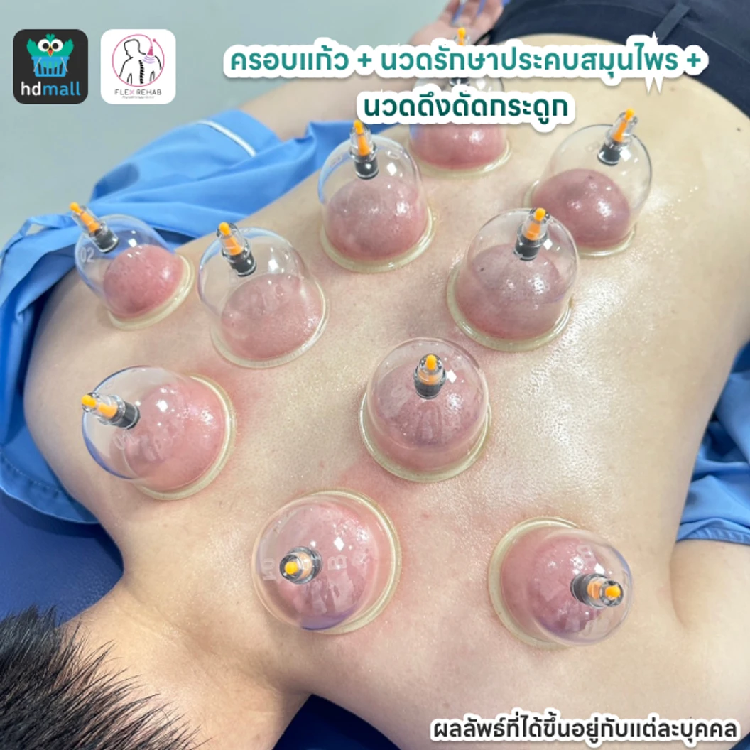 ครอบแก้ว + นวดรักษาประคบสมุนไพร + นวดดึงดัดกระดูก