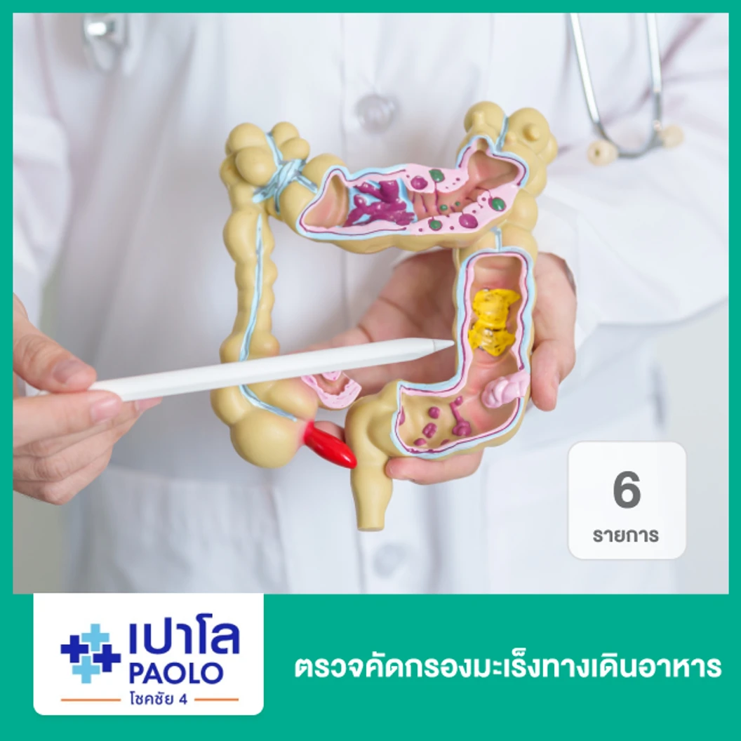 ตรวจคัดกรองมะเร็งทางเดินอาหาร 6 รายการ