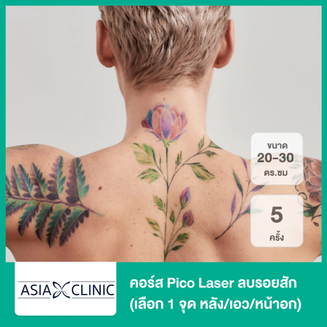 คอร์ส Pico Laser ลบรอยสัก ขนาด 20-30 ตร.ซม (เลือก 1 จุด หลัง/เอว/หน้าอก) 5 ครั้ง