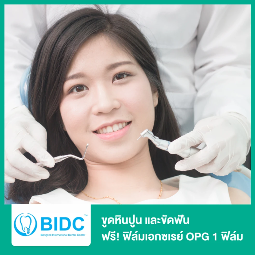 ขูดหินปูน และขัดฟัน ฟรี! ฟิล์มเอกซเรย์ OPG 1 ฟิล์ม
