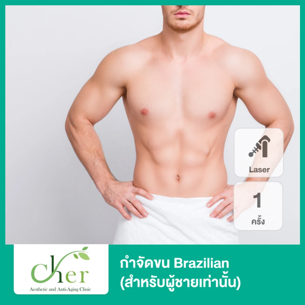 กำจัดขน Brazilian ด้วย Diode Laser 1 ครั้ง สำหรับผู้ชายเท่านั้น