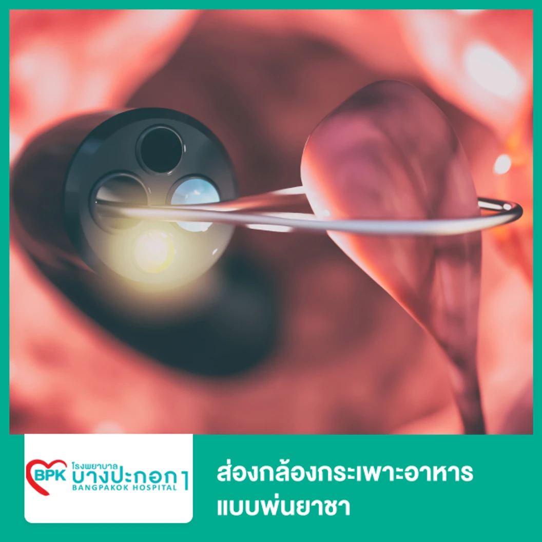 ส่องกล้องกระเพาะอาหาร แบบพ่นยาชา