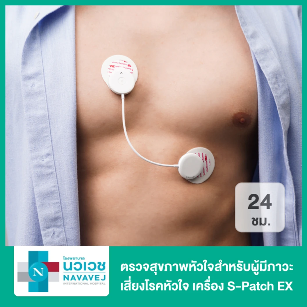 ตรวจสุขภาพหัวใจสำหรับผู้มีภาวะเสี่ยงโรคหัวใจหรือนักกีฬา ด้วยเครื่อง S-Patch EX 24 ชั่วโมง