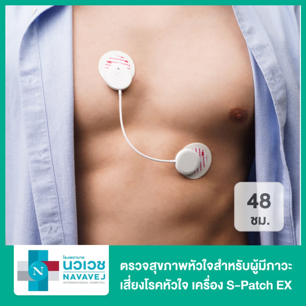 ตรวจสุขภาพหัวใจสำหรับผู้มีภาวะเสี่ยงโรคหัวใจหรือนักกีฬา ด้วยเครื่อง S-Patch EX 48 ชั่วโมง