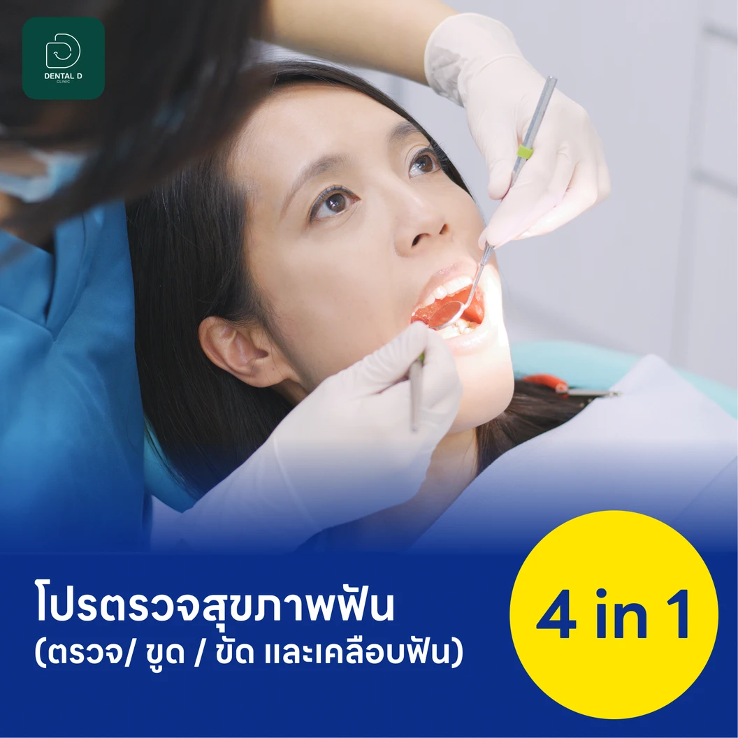 โปรแกรมตรวจสุขภาพฟัน 4 in 1 (ตรวจ+ขูด+ขัด+เคลือบ)