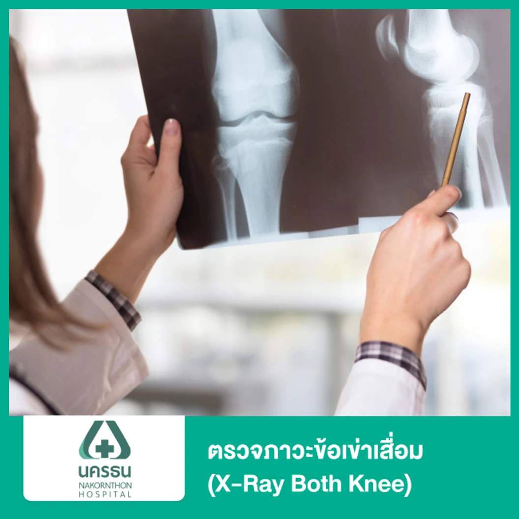 ตรวจวินิจฉัยอาการข้อเข่าเสื่อม ด้วยเครื่องเอกซ์เรย์ข้อเข่า 2 ข้าง