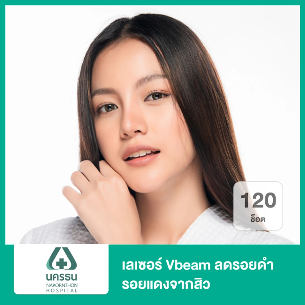 เลเซอร์ Vbeam ลดรอยดำ รอยแดงจากสิว 120 ช็อต