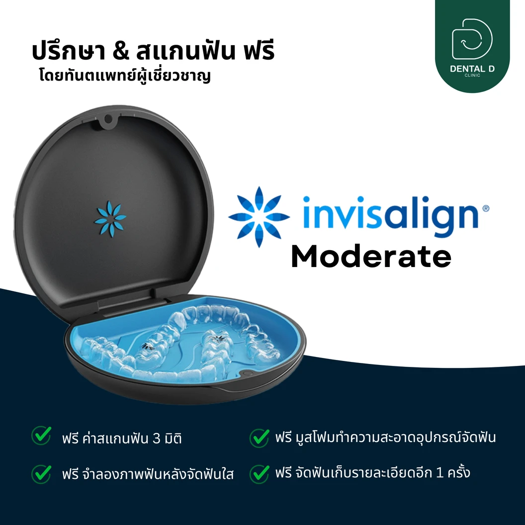 จัดฟันใส Invisalign Moderate ฟันบนและล่าง