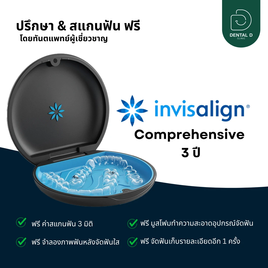 จัดฟันใส Invisalign Comprehensive 1 ฟันบนและล่าง ไม่จำกัดชิ้นงาน 3 ปี