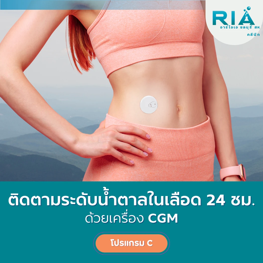 ติดเครื่อง CGM ติดตามระดับน้ำตาลในเลือด 1 เครื่อง (โปรแกรม C) (12 วัน)