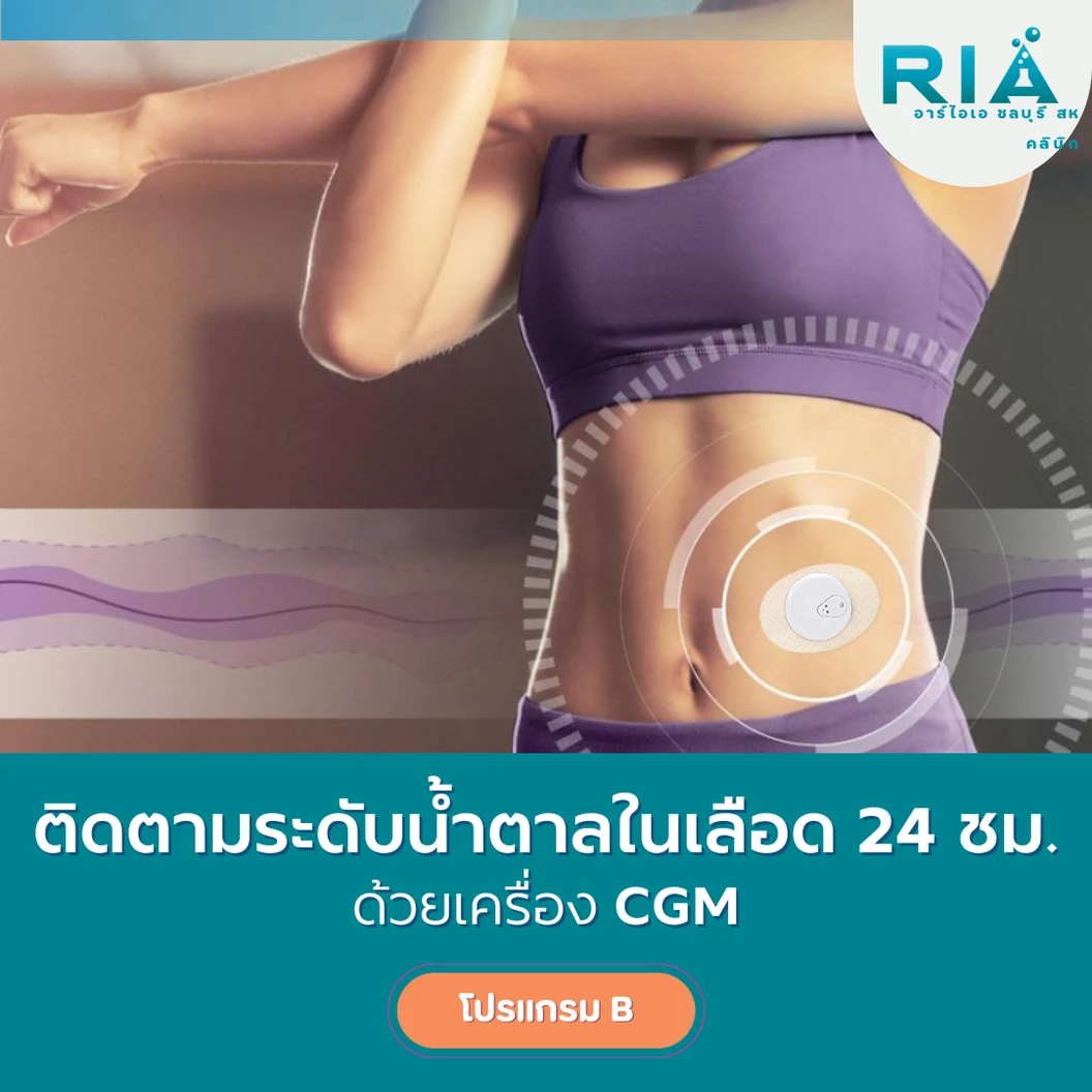 ติดเครื่อง CGM ติดตามระดับน้ำตาลในเลือด 1 เครื่อง (โปรแกรม B) พร้อมนักกำหนดอาหารติดตามการรับประทานอาหาร (12 วัน)